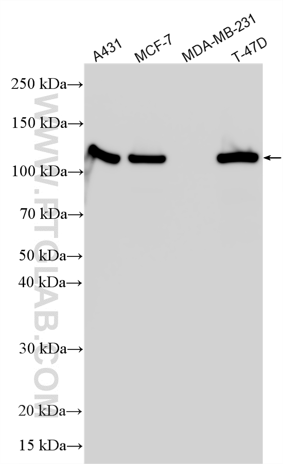 WB analysis using RMX00039