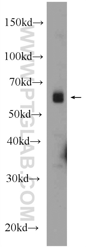 E2F1 Polyclonal antibody