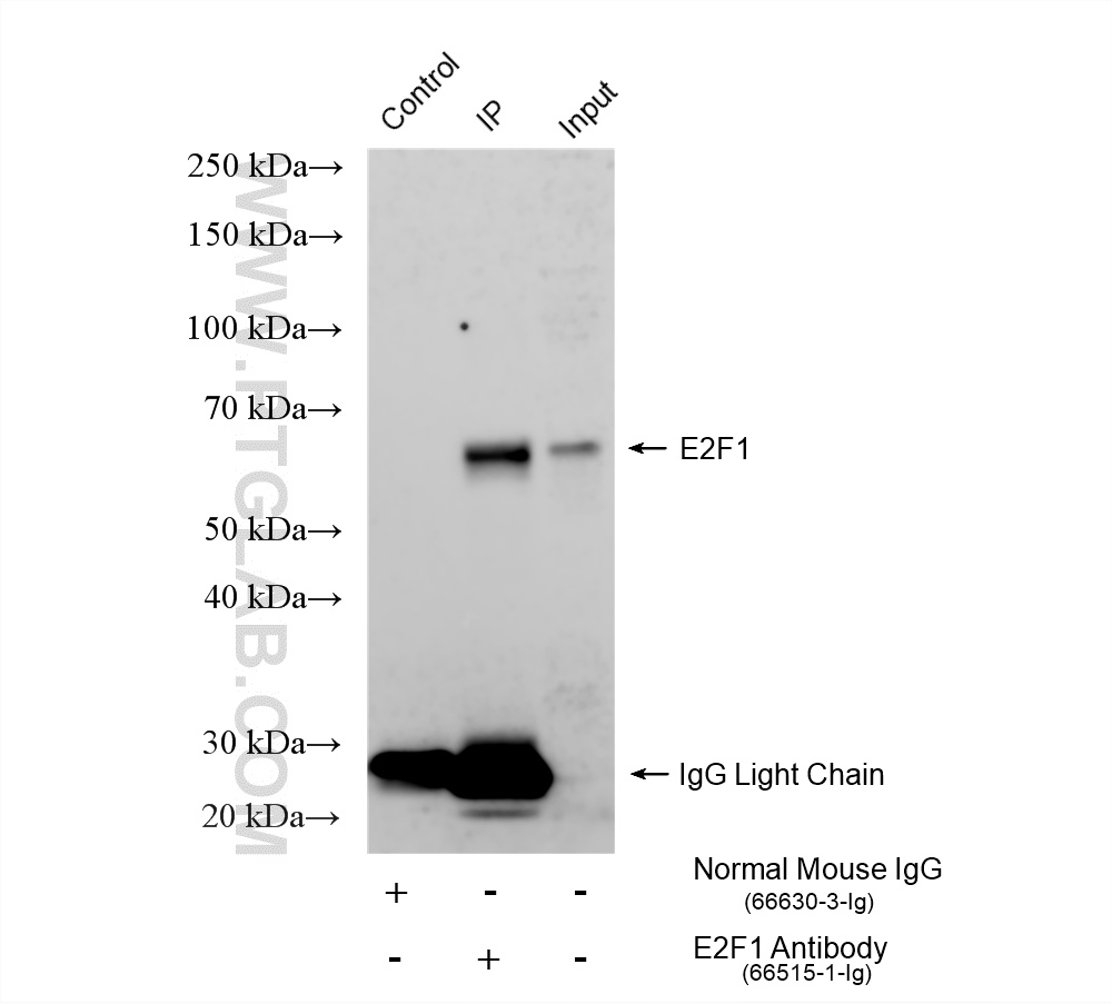 IP experiment of HEK-293T using 66515-1-Ig IP experiment of HEK-293T using 66515-1-Ig