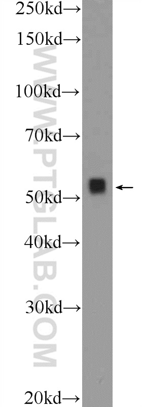 WB analysis of Y79 using 12334-1-AP