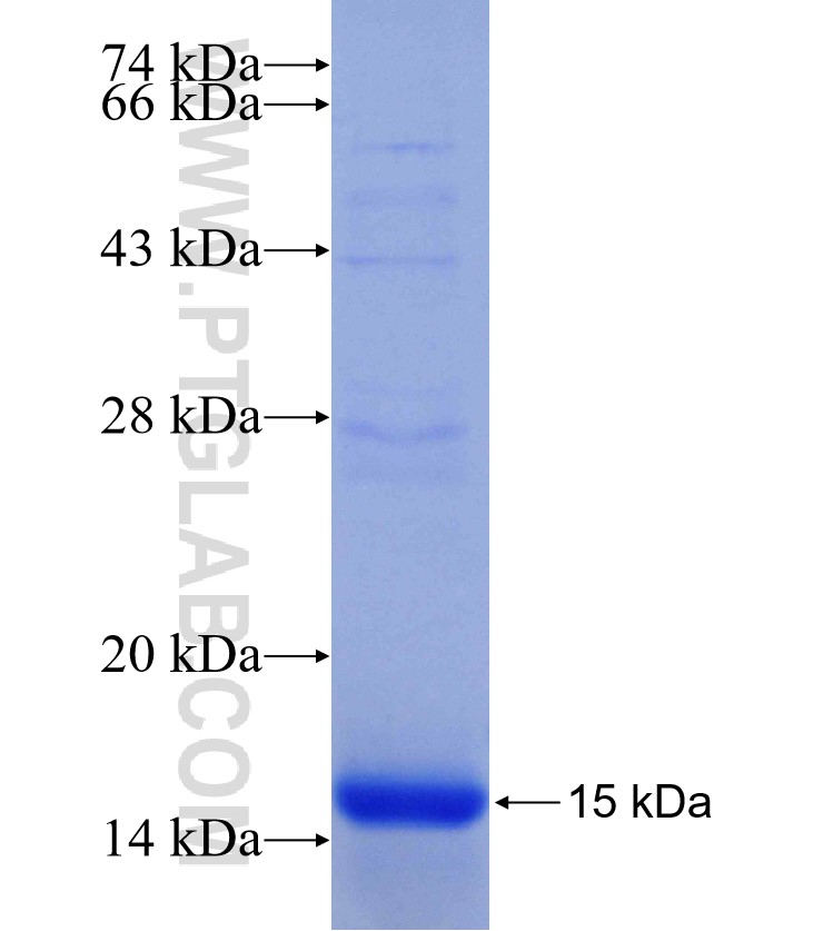 E2F3 fusion protein Ag14560 SDS-PAGE E2F3 fusion protein Ag14560 SDS-PAGE
