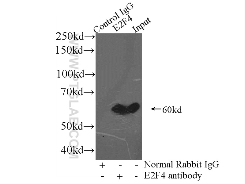 IP experiment of mouse brain using 10923-1-AP