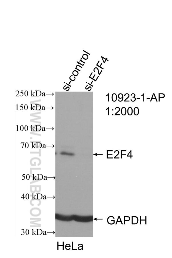 WB analysis of HeLa using 10923-1-AP