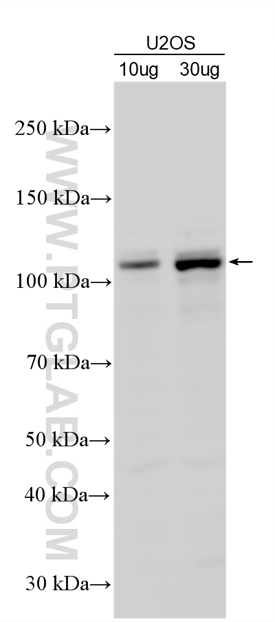 Various lysates were subjected to SDS PAGE followed by western blot with 24489-1-AP (E2F7 antibody) at dilution of 1:1000 incubated at room temperature for 1.5 hours. WB analysis using 24489-1-AP