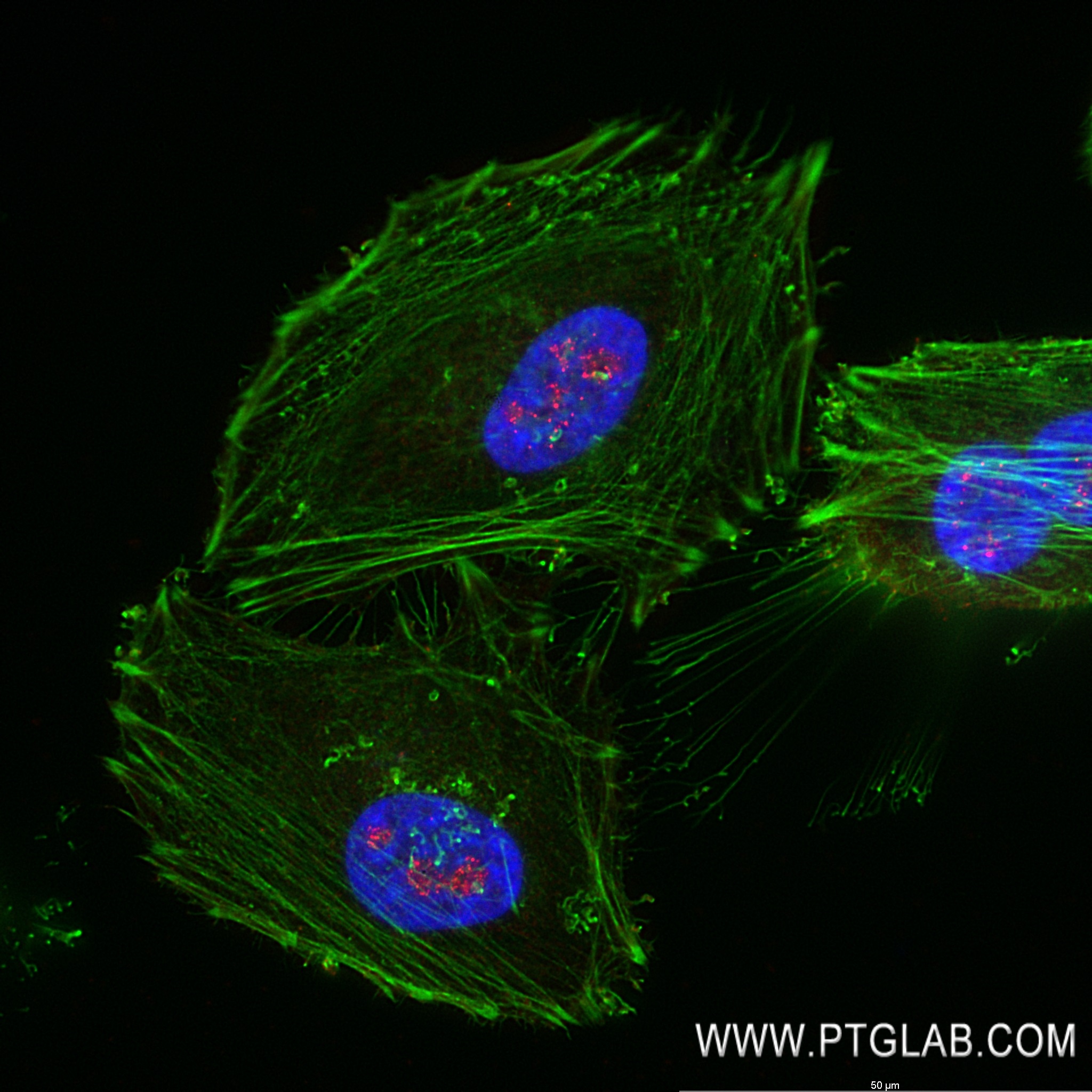 IF Staining of HeLa using 82887-1-RR