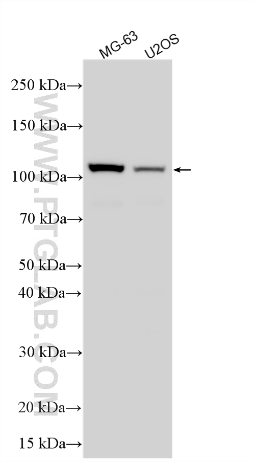 Various lysates were subjected to SDS PAGE followed by western blot with 82887-2-RR (E2F7 antibody) at dilution of 1:600 incubated at room temperature for 1.5 hours. WB analysis using 82887-2-RR
