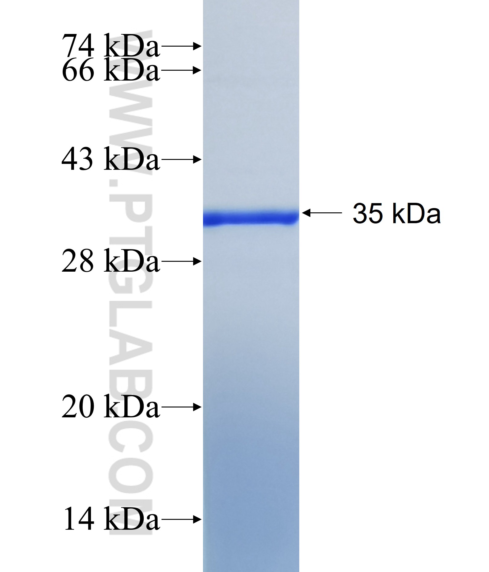 E2F7 fusion protein Ag40486 SDS-PAGE E2F7 fusion protein Ag40486 SDS-PAGE