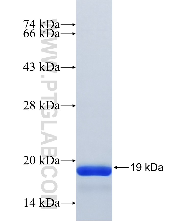 E2F7 fusion protein Ag40601 SDS-PAGE E2F7 fusion protein Ag40601 SDS-PAGE