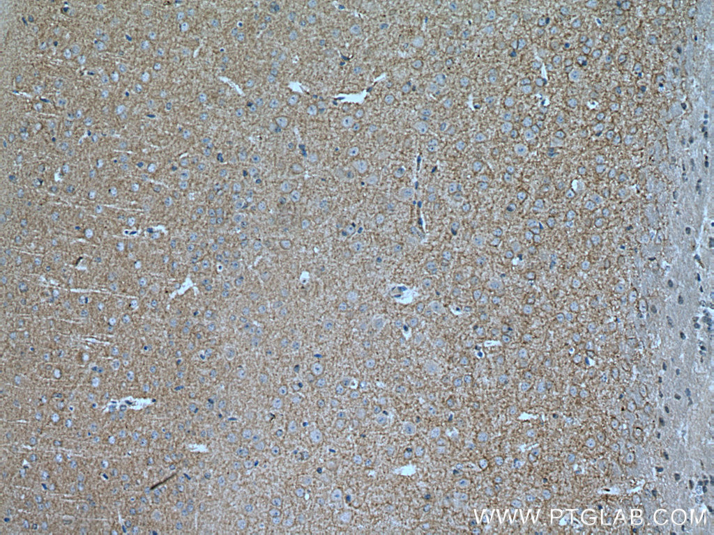 IHC staining of mouse brain using 67083-1-Ig