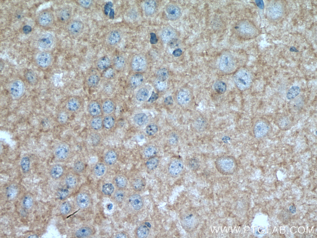 IHC staining of mouse brain using 67083-1-Ig