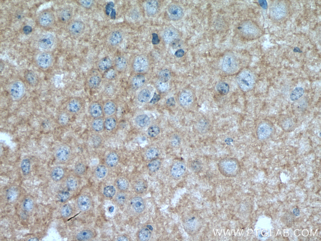 IHC staining of mouse brain using 67083-1-Ig (same clone as 67083-1-PBS)