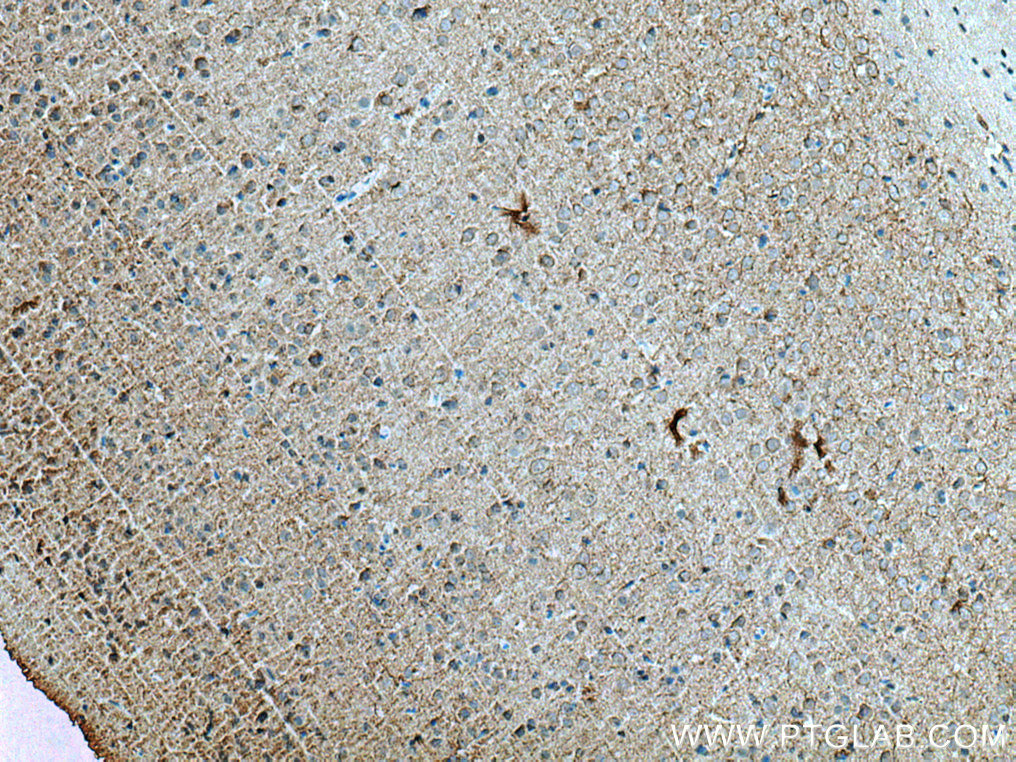 IHC staining of rat brain using 67083-1-Ig (same clone as 67083-1-PBS)