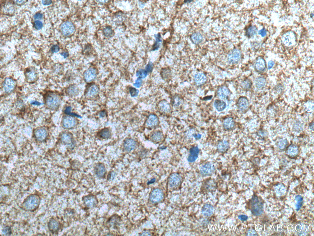 IHC staining of rat brain using 67083-1-Ig