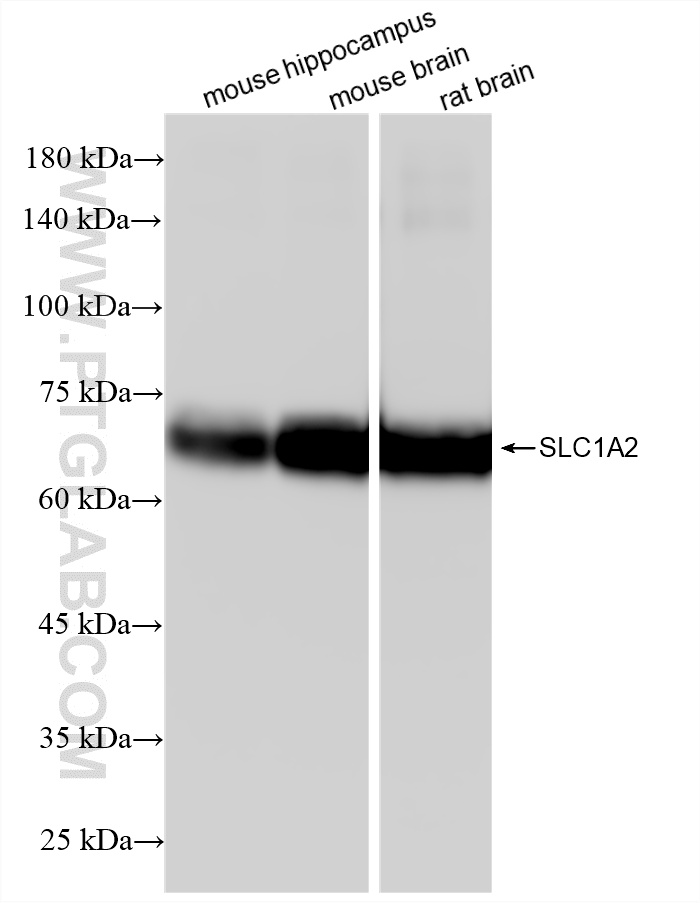 WB analysis using 88675-1-RR (same clone as 88675-1-PBS) WB analysis using 88675-1-RR (same clone as 88675-1-PBS)