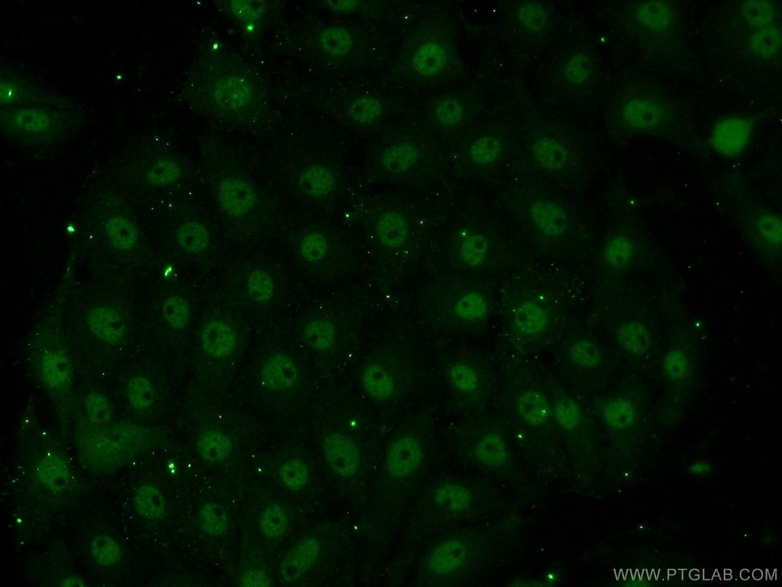 IF Staining of SH-SY5Y using 13787-1-AP