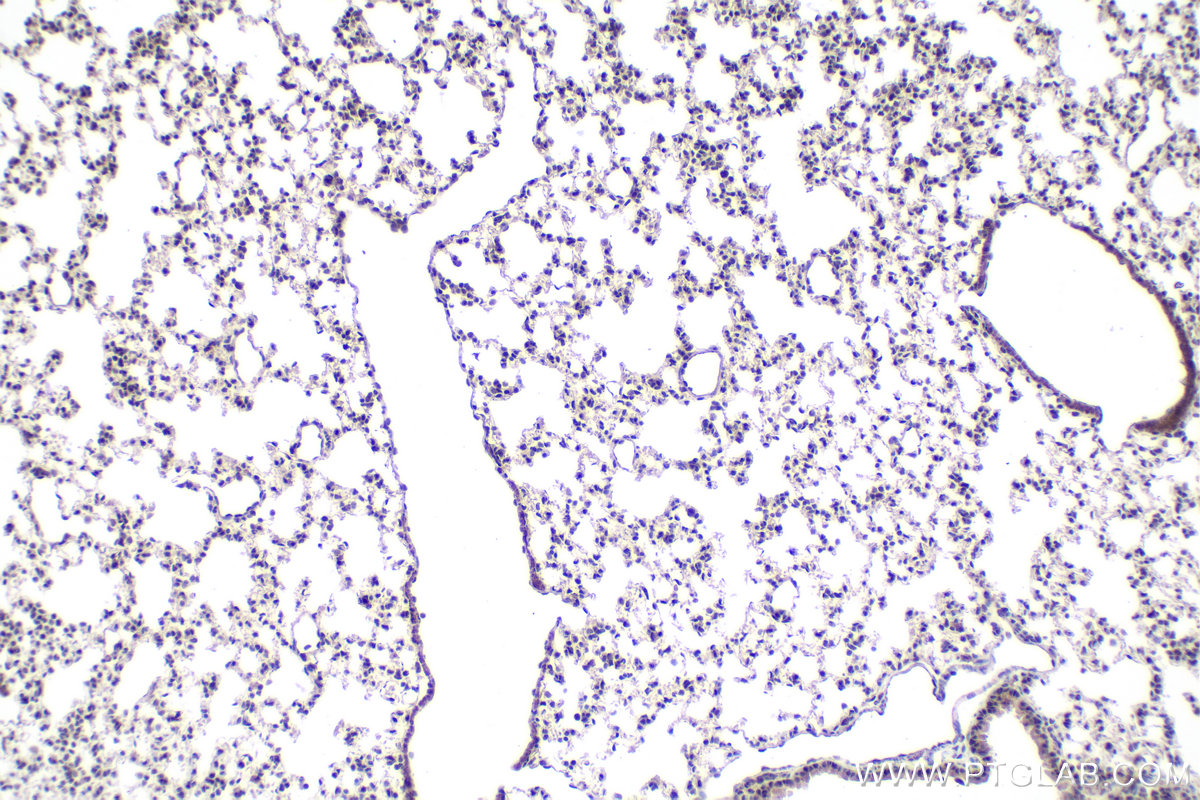 IHC staining of mouse lung using 13787-1-AP IHC staining of mouse lung using 13787-1-AP