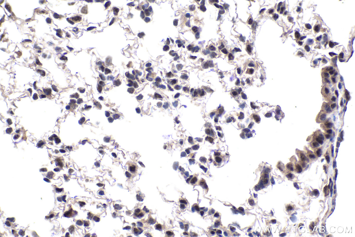 IHC staining of mouse lung using 13787-1-AP IHC staining of mouse lung using 13787-1-AP