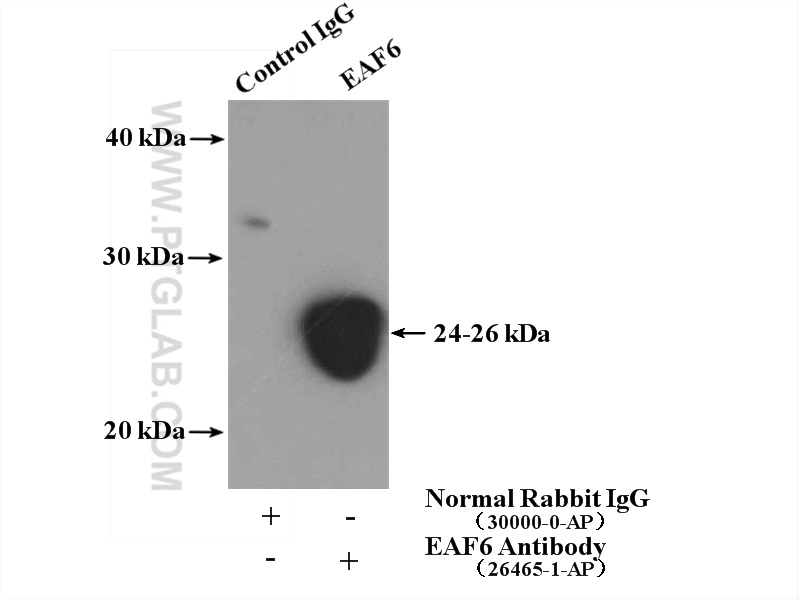 IP experiment of HepG2 using 26465-1-AP