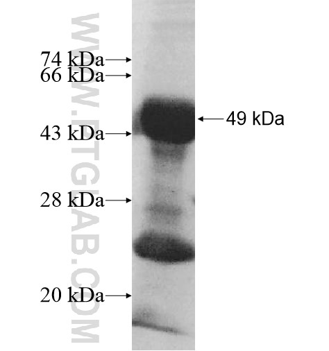 EAPP fusion protein Ag10416 SDS-PAGE EAPP fusion protein Ag10416 SDS-PAGE