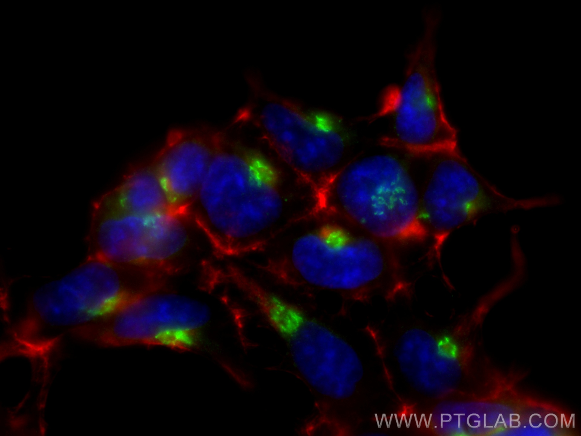 IF Staining of HEK-293 using 12255-1-AP