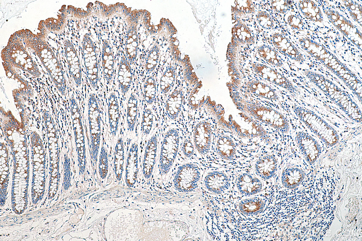 IHC staining of human colon using 12255-1-AP