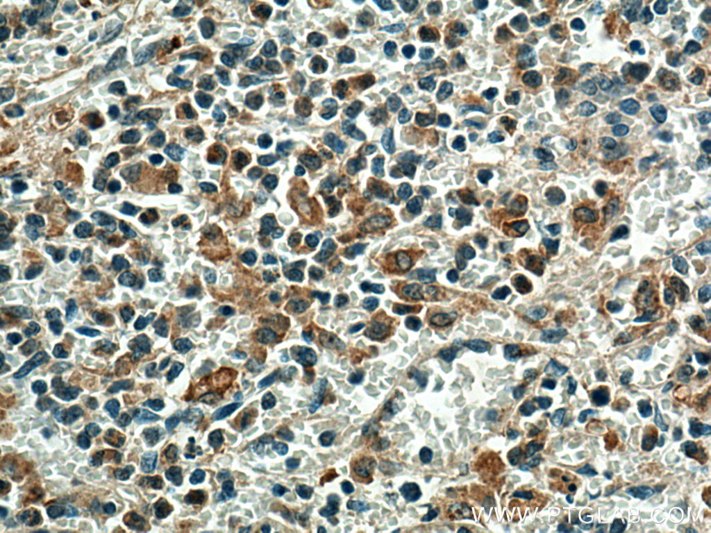 IHC staining of human spleen using 12371-1-AP