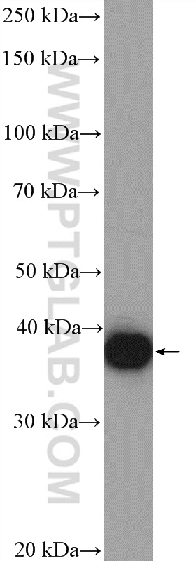 WB analysis of MCF-7 using 15973-1-AP