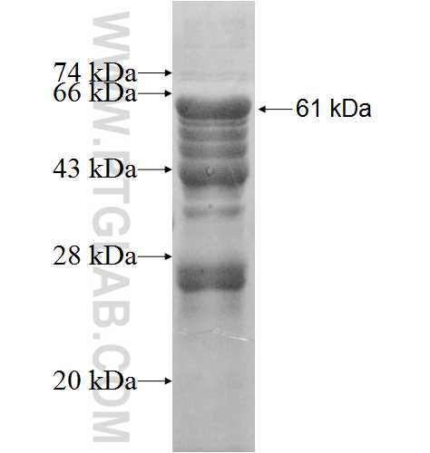 EBP2 fusion protein Ag8760 SDS-PAGE