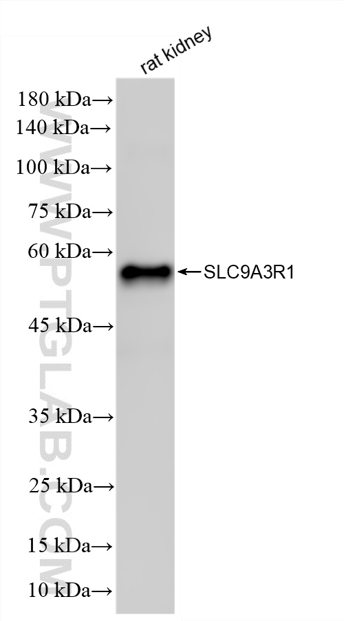 WB analysis of rat kidney using 87174-1-RR (same clone as 87174-1-PBS)