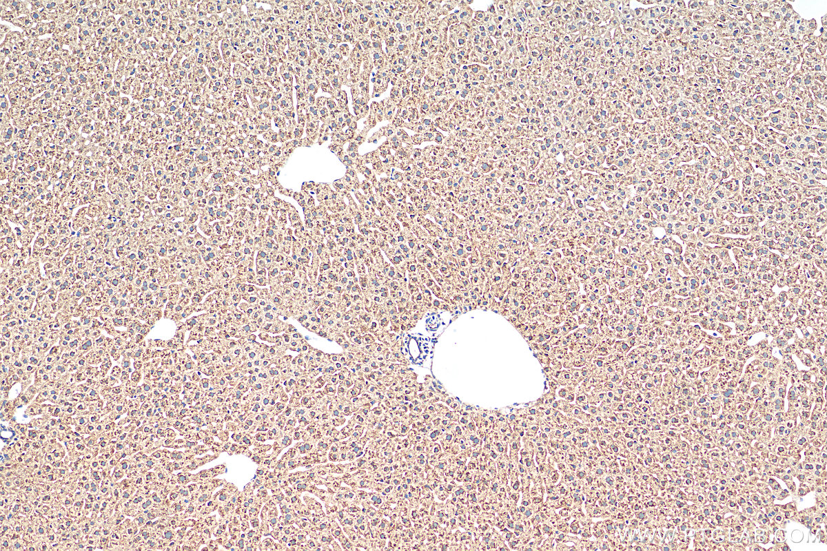 IHC staining of mouse liver using 17904-1-AP