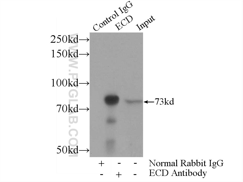 IP experiment of HeLa using 10192-1-AP