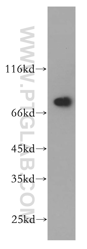 WB analysis of HeLa using 10192-1-AP