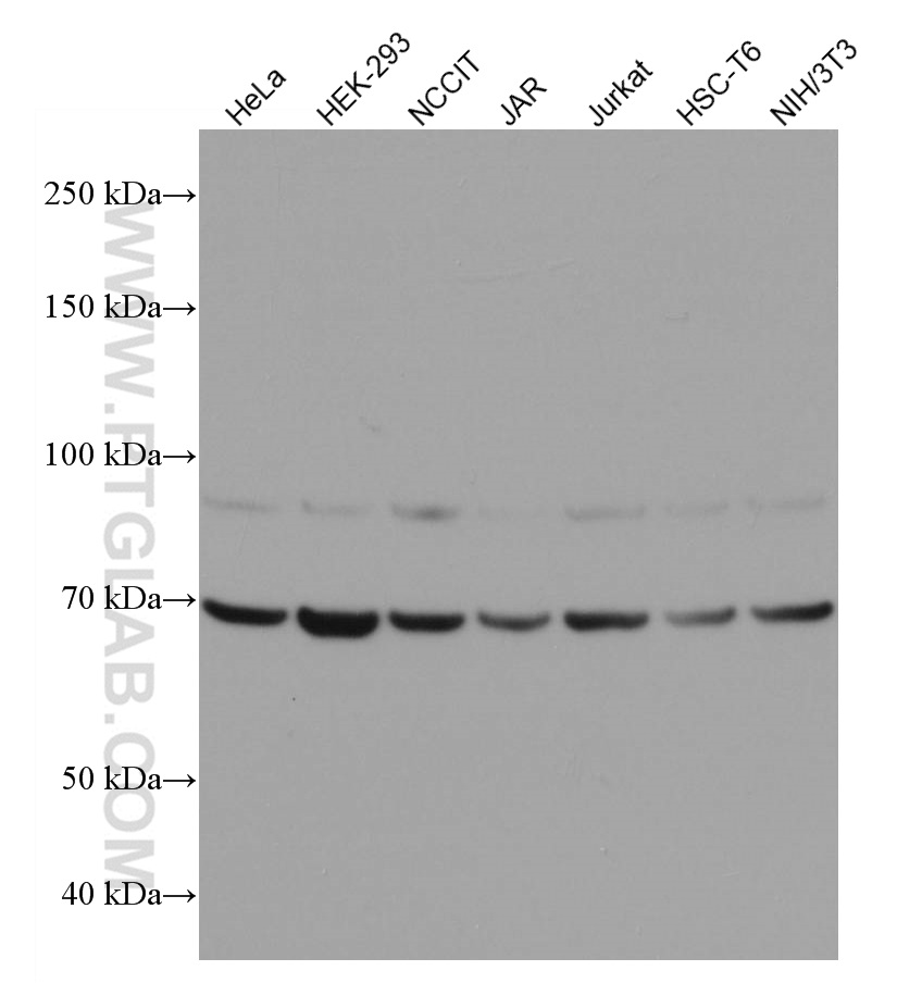 WB analysis using 67179-1-Ig