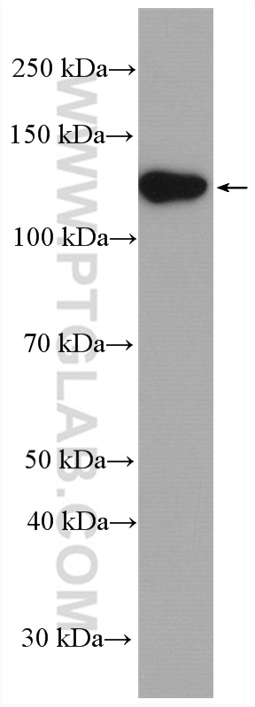 WB analysis using 26088-1-AP