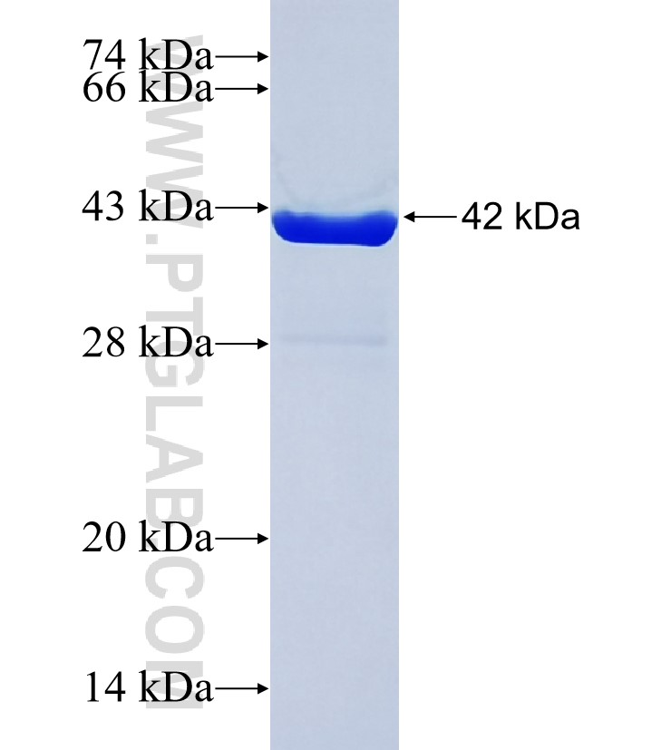 ECE2 fusion protein Ag37529 SDS-PAGE ECE2 fusion protein Ag37529 SDS-PAGE
