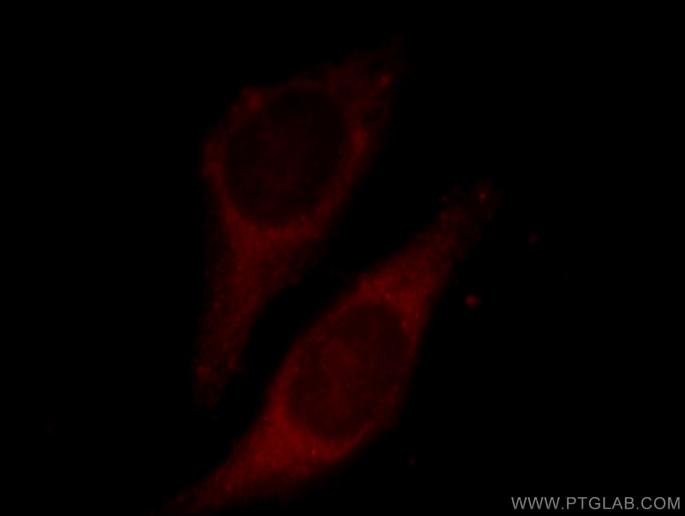 IF Staining of HepG2 using 11385-1-AP