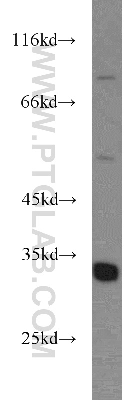 WB analysis of mouse liver using 11385-1-AP