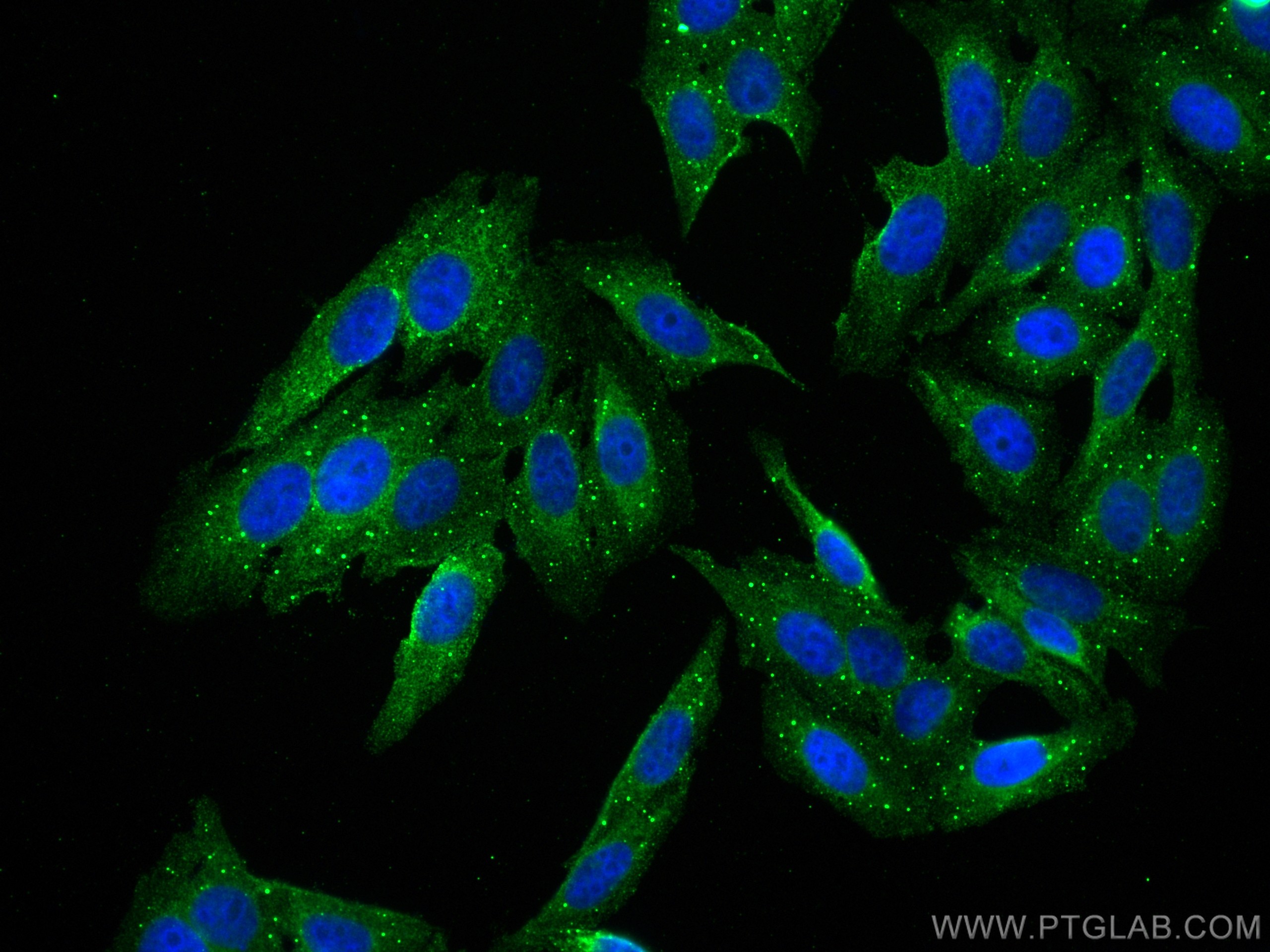 IF Staining of HepG2 using 68139-1-Ig (same clone as 68139-1-PBS)