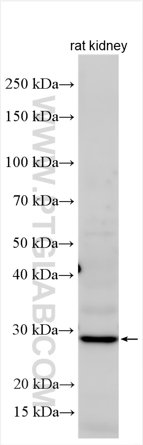 WB analysis using 26126-1-AP