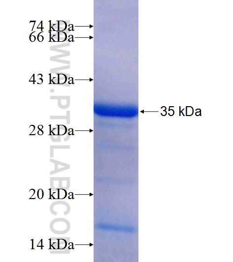 ECHDC3 fusion protein Ag25707 SDS-PAGE ECHDC3 fusion protein Ag25707 SDS-PAGE
