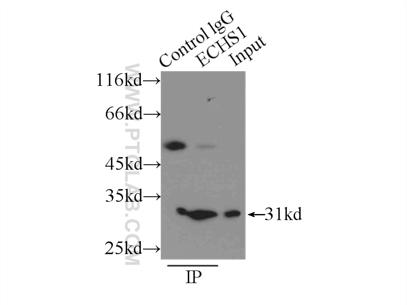 IP experiment of PC-3 using 11305-1-AP