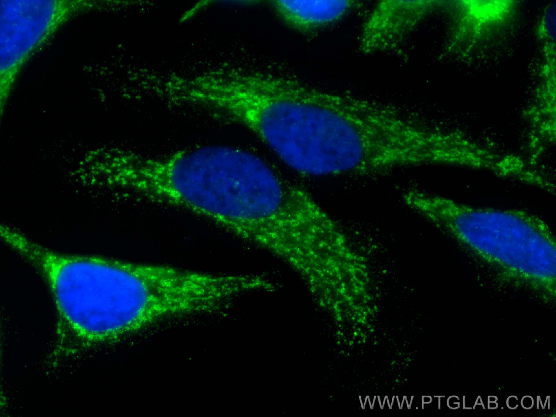 IF Staining of HeLa using 66117-1-Ig (same clone as 66117-1-PBS)