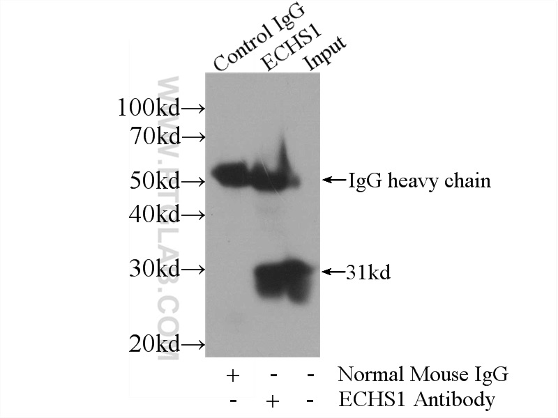 IP experiment of HepG2 using 66117-1-Ig