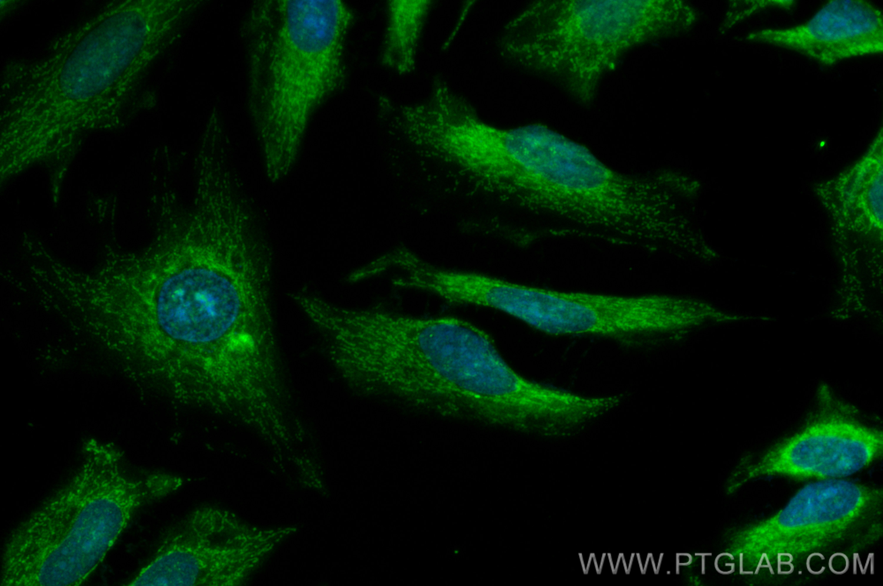 IF Staining of HeLa using CL488-11305