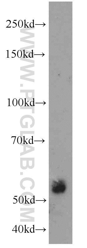 WB analysis of A549 using 11521-1-AP