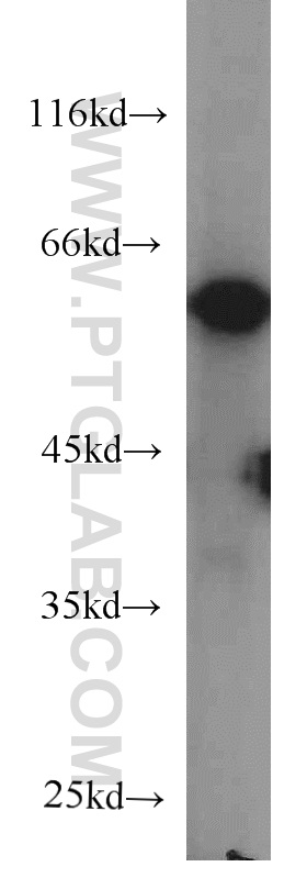 WB analysis of MCF-7 using 66023-1-Ig