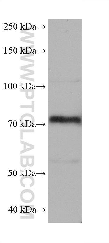 WB analysis of A431 using 68472-1-Ig