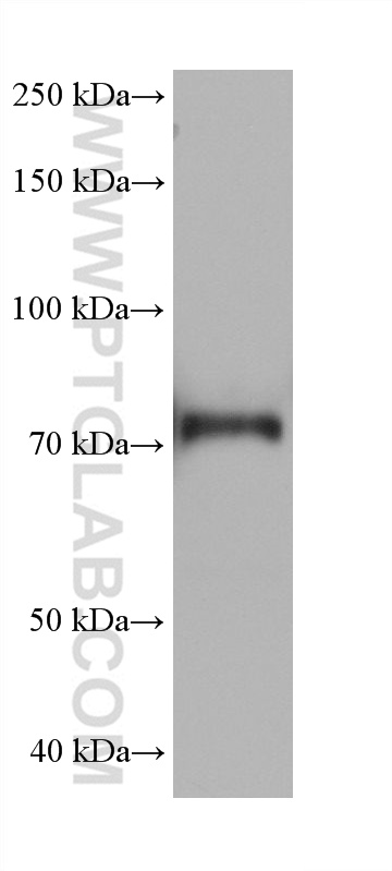 WB analysis of K-562 using 68472-1-Ig