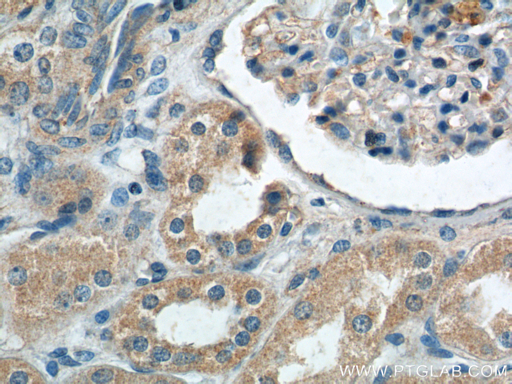 IHC staining of human kidney using 12611-1-AP