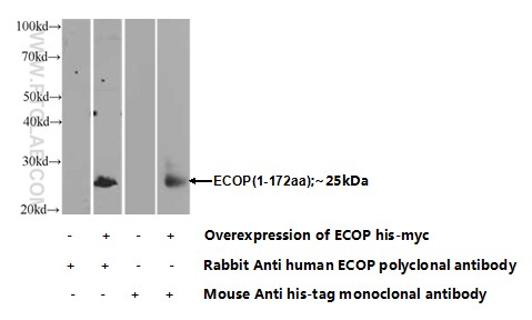 WB analysis of Transfected HEK-293 using 12611-1-AP